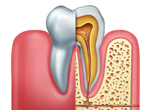 illustration of root canal